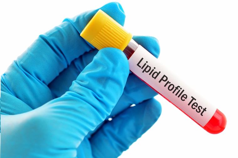 Lipid testing.jpg