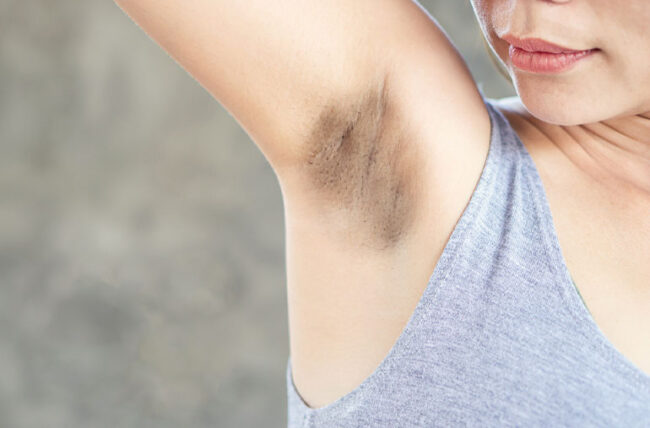 dark armpits.jpg