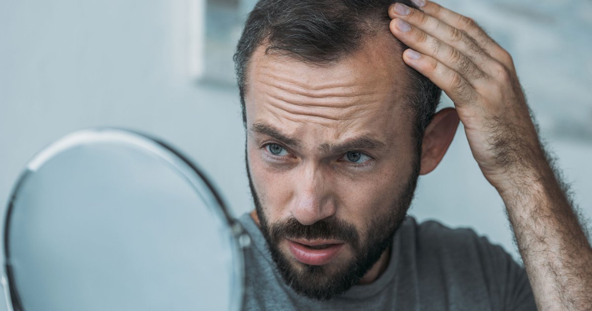 hair-loss thumbnail