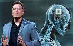 Elon Musk’s Brain Implant Company Approved For Human Testing